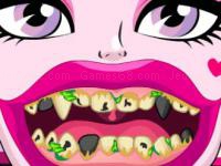 Draculaura bad teeth